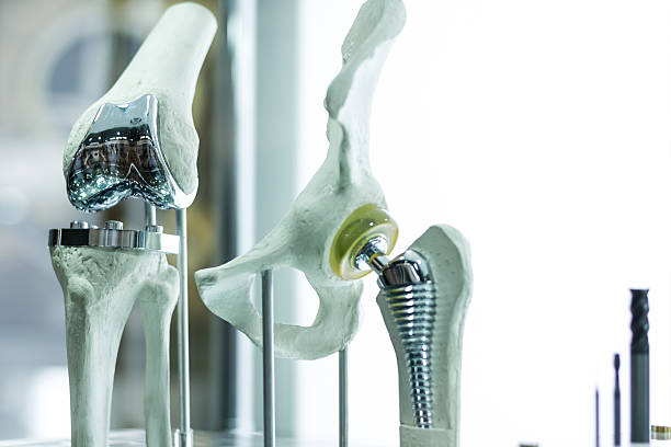 Artificial knee replacement