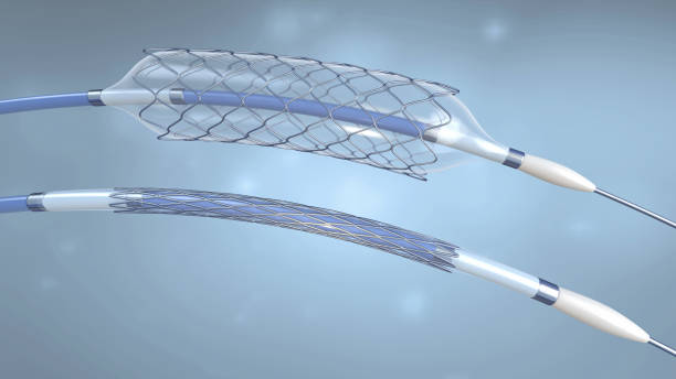 Cardiovascular stent